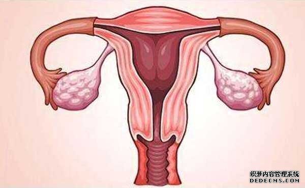 子宫内膜异常造成不孕